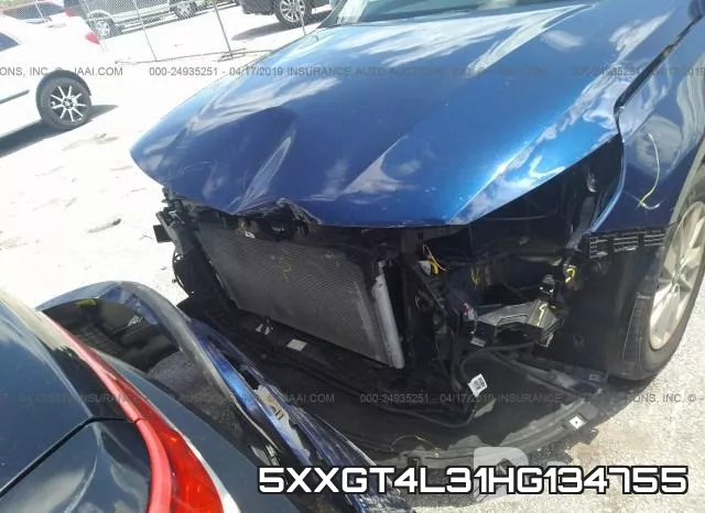 5XXGT4L31HG134755 фото 7