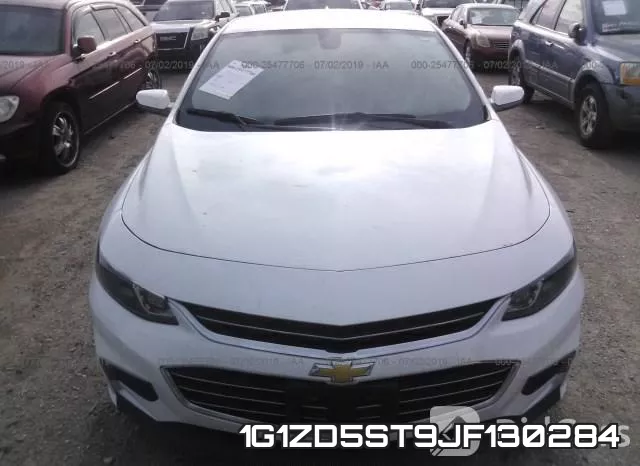 1G1ZD5ST9JF130284 фото 7