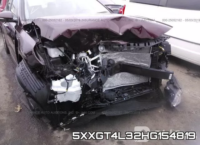 5XXGT4L32HG154819 фото 6