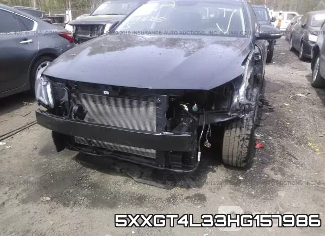 5XXGT4L33HG157986 фото 7