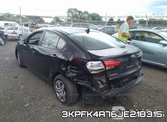 3KPFK4A76JE218315 фото 4