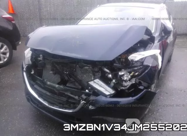 3MZBN1V34JM255202 фото 7
