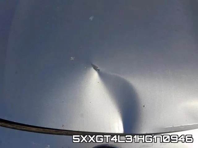 5XXGT4L31HG170946 фото 7