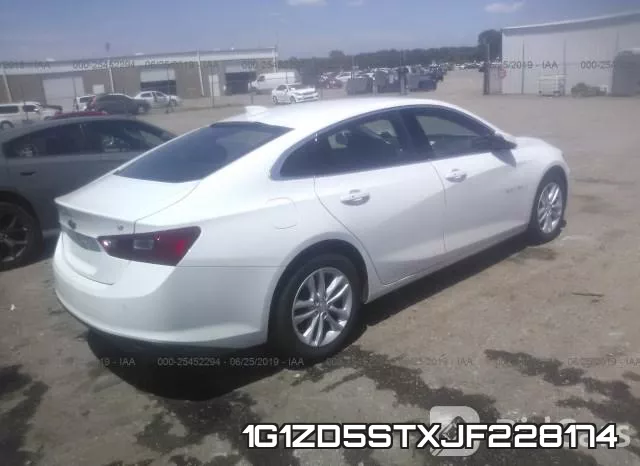 1G1ZD5STXJF228174 фото 5