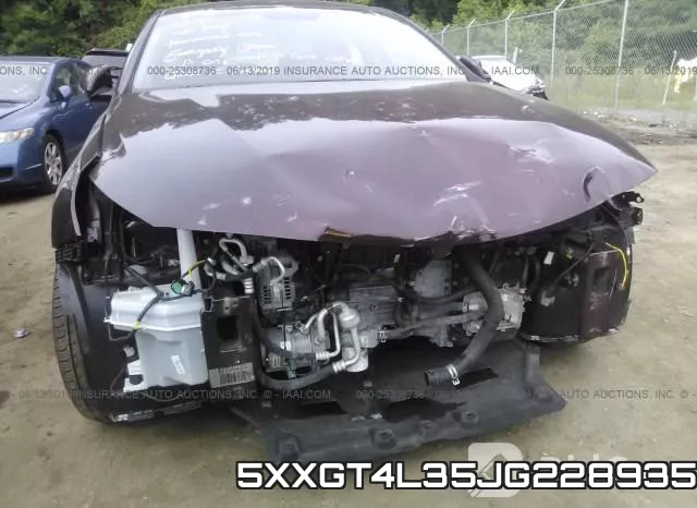 5XXGT4L35JG228935 фото 7