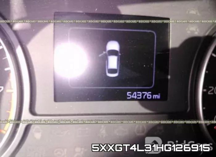 5XXGT4L31HG126915 фото 8