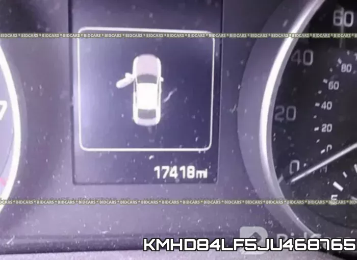 KMHD84LF5JU468765 фото 8