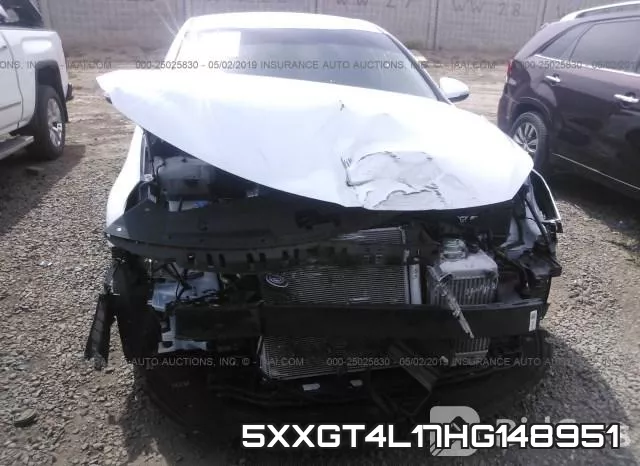 5XXGT4L17HG148951 фото 7