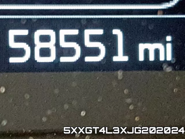 5XXGT4L3XJG202024 фото 9