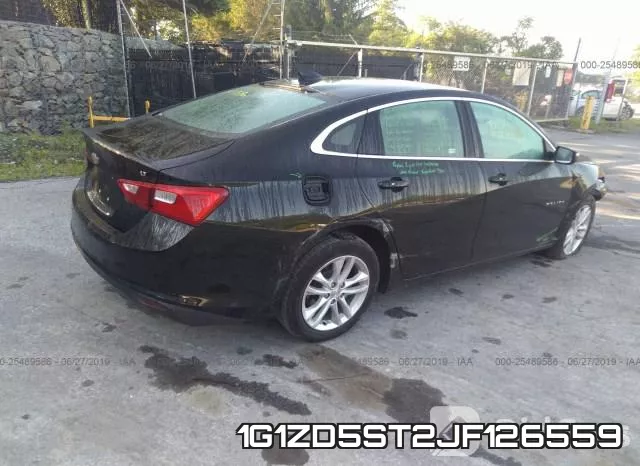 1G1ZD5ST2JF126559 фото 5