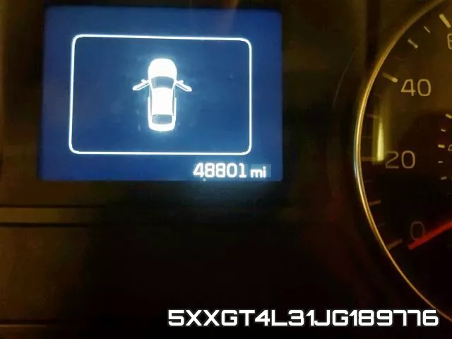 5XXGT4L31JG189776 фото 9