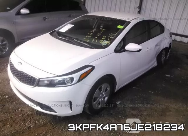 3KPFK4A76JE218234 фото 3