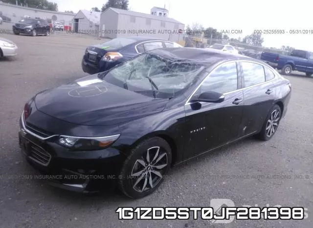 1G1ZD5ST0JF281398 фото 3