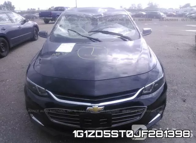 1G1ZD5ST0JF281398 фото 7