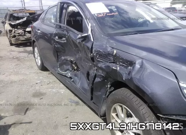 5XXGT4L31HG178142 фото 7