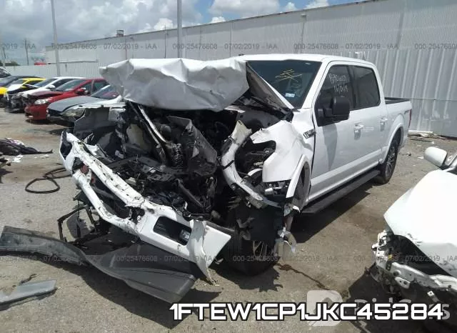 1FTEW1CP1JKC45284 фото 3