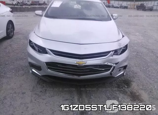 1G1ZD5ST1JF138220 фото 7