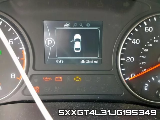 5XXGT4L31JG195349 фото 9