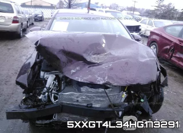 5XXGT4L34HG173291 фото 7