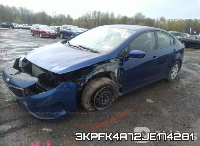 3KPFK4A72JE174281 фото 3