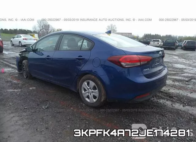 3KPFK4A72JE174281 фото 4