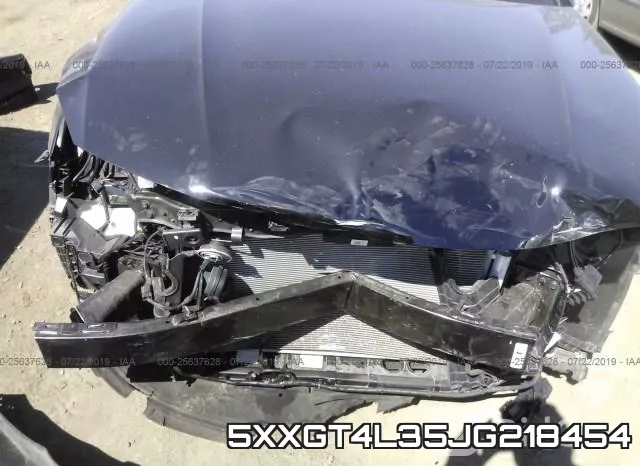 5XXGT4L35JG218454 фото 7