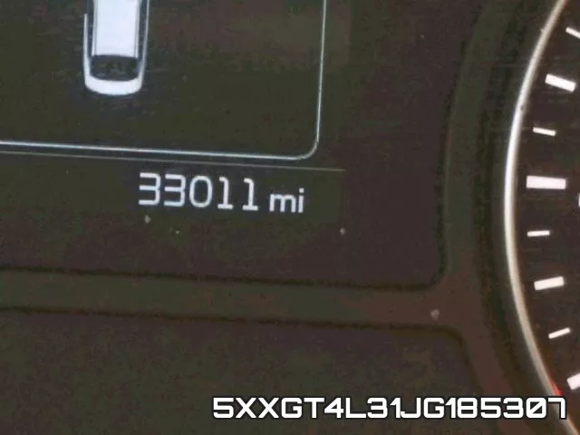5XXGT4L31JG185307 фото 9