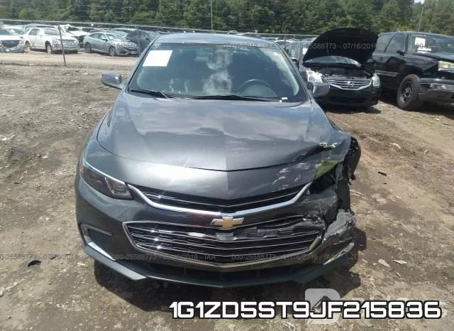 1G1ZD5ST9JF215836 фото 7