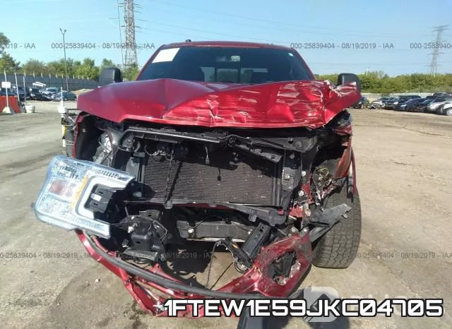 1FTEW1E59JKC04705 фото 7