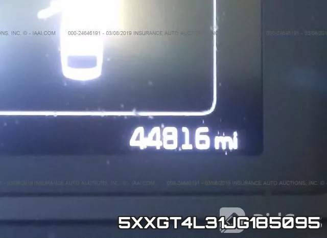 5XXGT4L31JG185095 фото 8