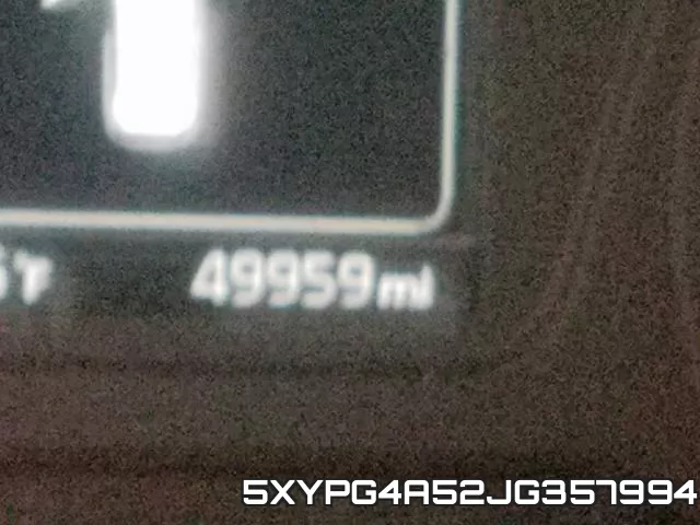 5XYPG4A52JG357994 фото 9