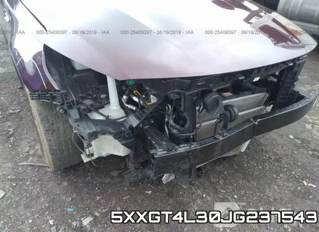5XXGT4L30JG237543 фото 7