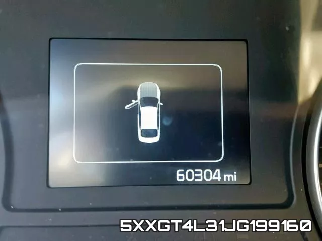 5XXGT4L31JG199160 фото 9