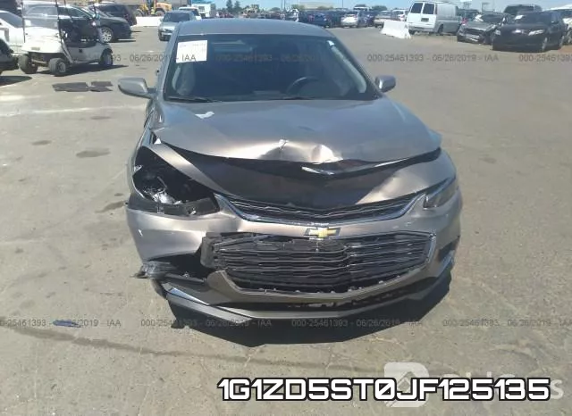 1G1ZD5ST0JF125135 фото 7