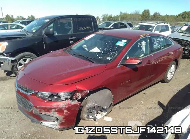 1G1ZD5ST6JF142148 фото 3
