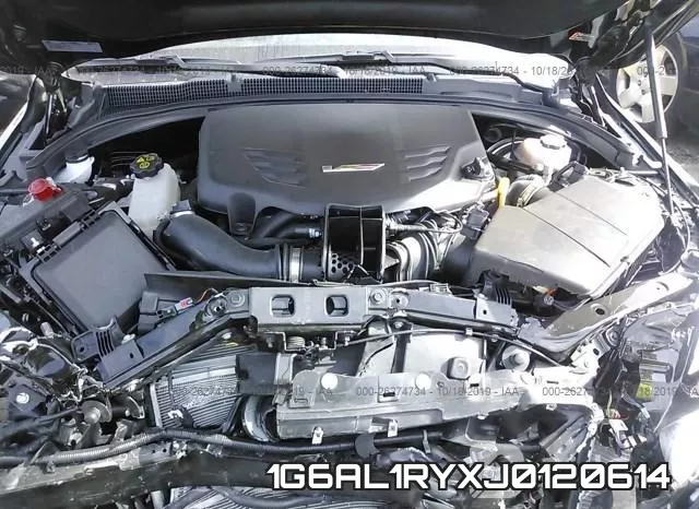 1G6AL1RYXJ0120614 фото 2