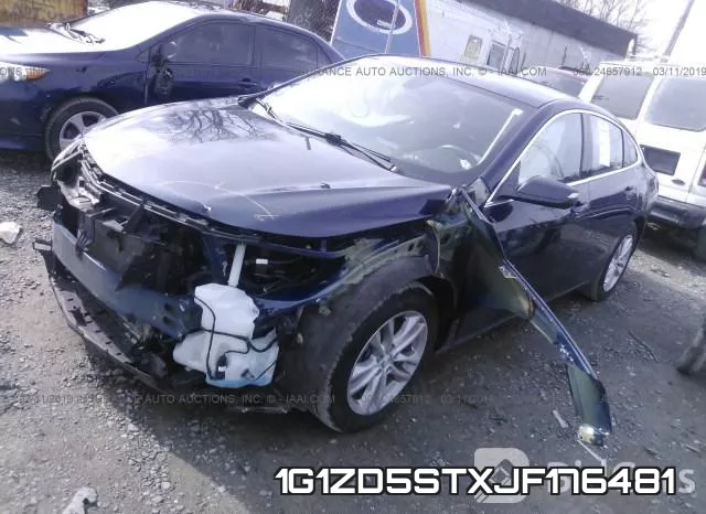 1G1ZD5STXJF176481 фото 3