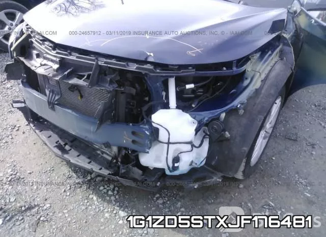 1G1ZD5STXJF176481 фото 7