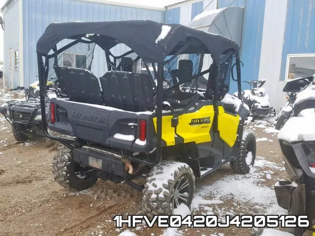 1HFVE0420J4205126 фото 5