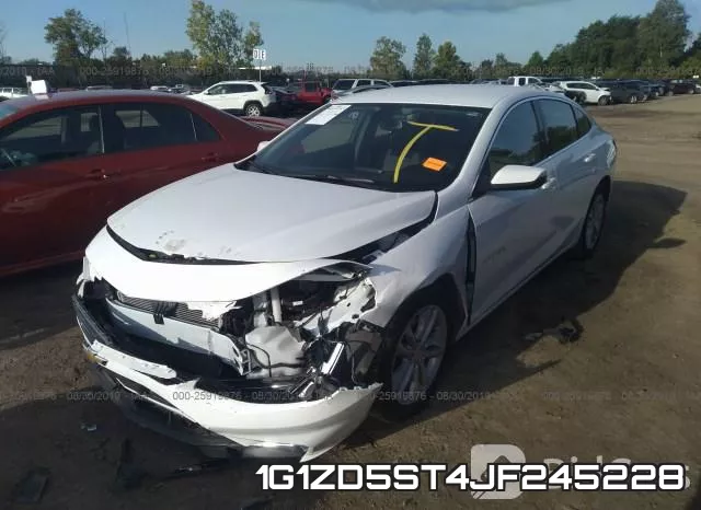 1G1ZD5ST4JF245228 фото 3