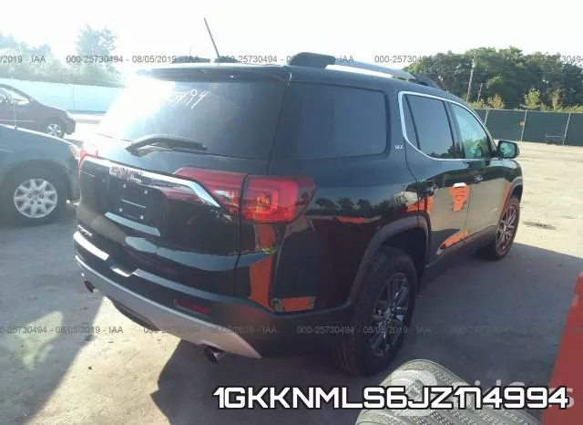 1GKKNMLS6JZ174994 фото 5