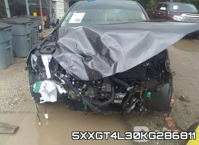 5XXGT4L30KG286811 фото 6