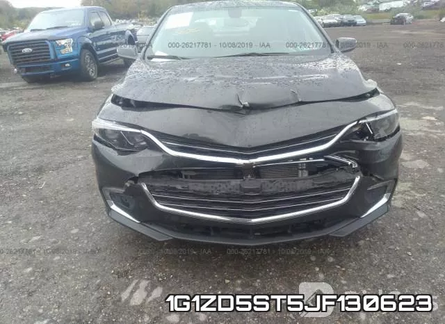 1G1ZD5ST5JF130623 фото 7