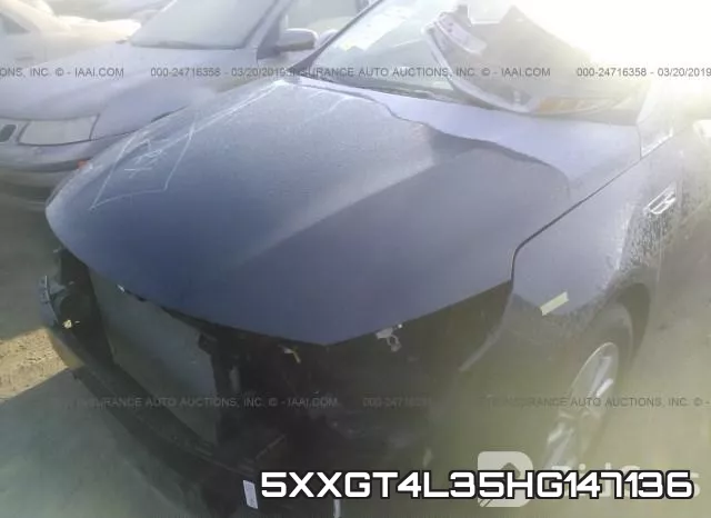 5XXGT4L35HG147136 фото 7