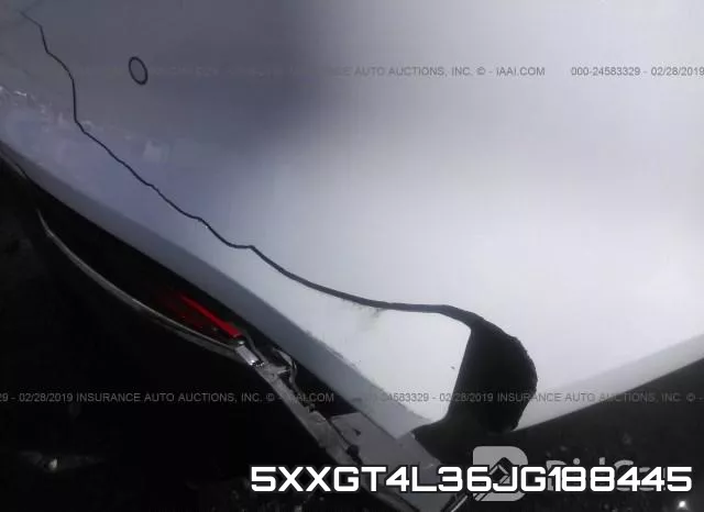 5XXGT4L36JG188445 фото 7