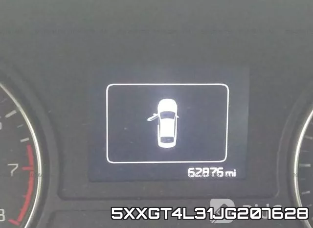 5XXGT4L31JG207628 фото 8