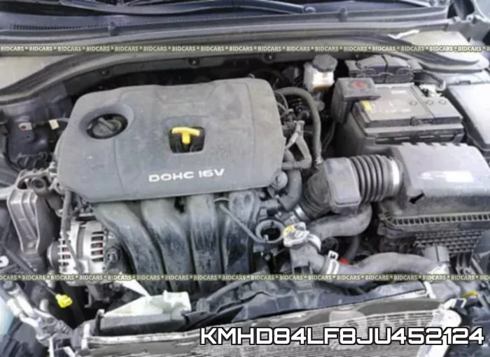 KMHD84LF8JU452124 фото 2