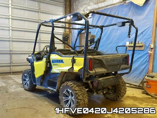 1HFVE0420J4205286 фото 4