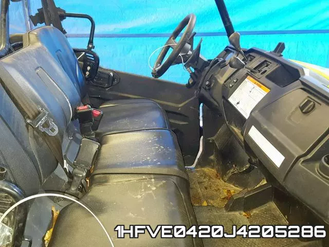 1HFVE0420J4205286 фото 6
