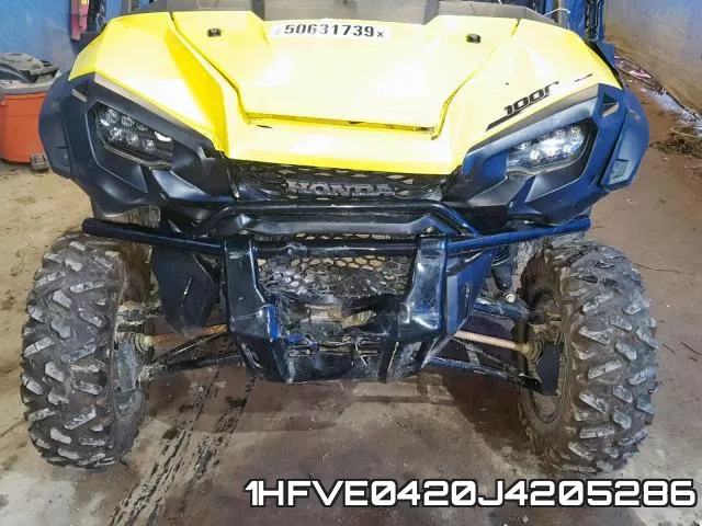 1HFVE0420J4205286 фото 10